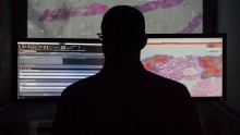 AI at Unilabs